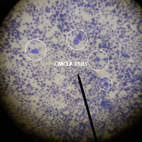 Cancerous cells in a female dog