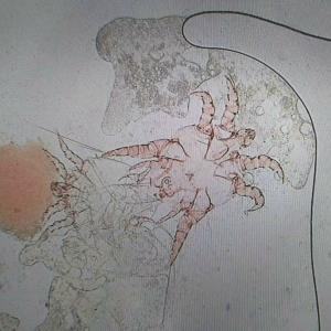 Ear Mite under microscope